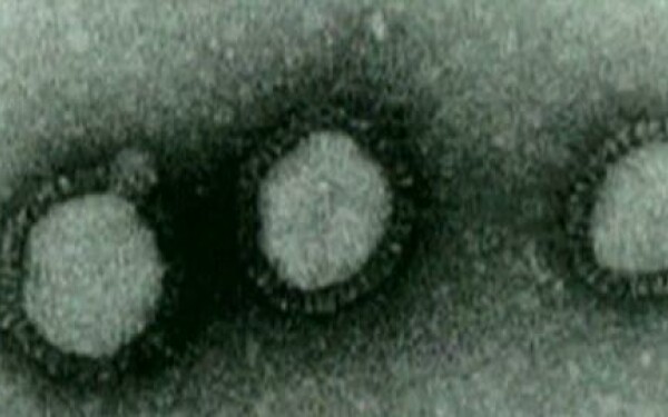 Virus Virus