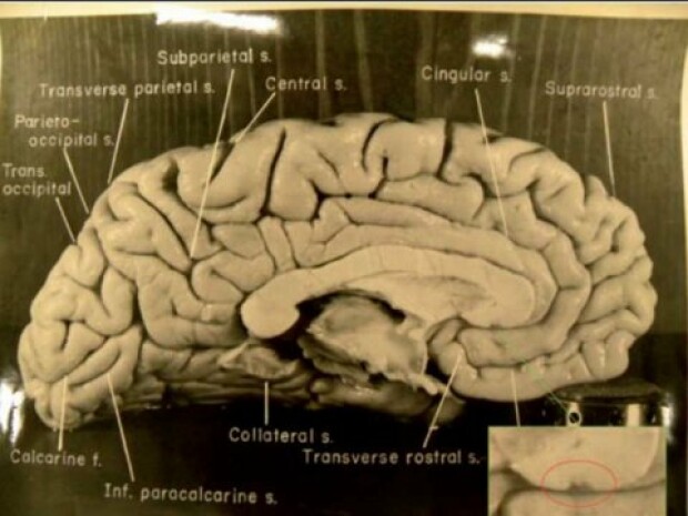 creierul lui Einstein