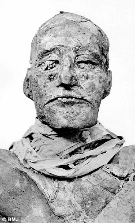 mumie Ramses III