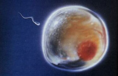 Ovule Ovule