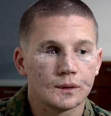 William Kyle Carpenter