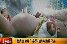 China gravid