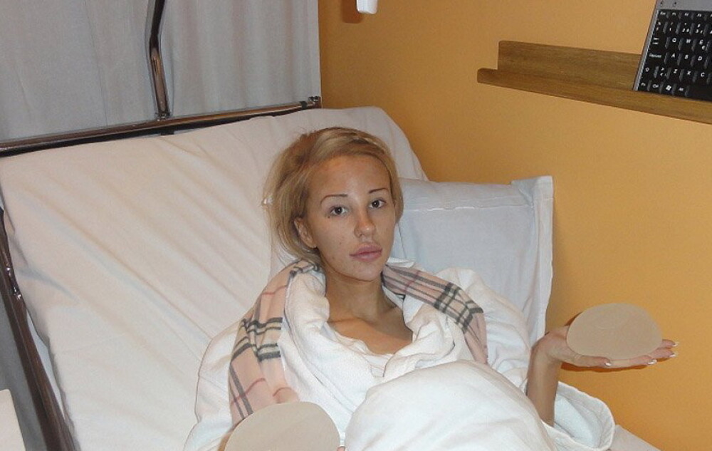 “Am iesit din spital dupa 12 operatii estetice”. Cum arata acum o suedeza obsedata de frumusete - Imaginea 6