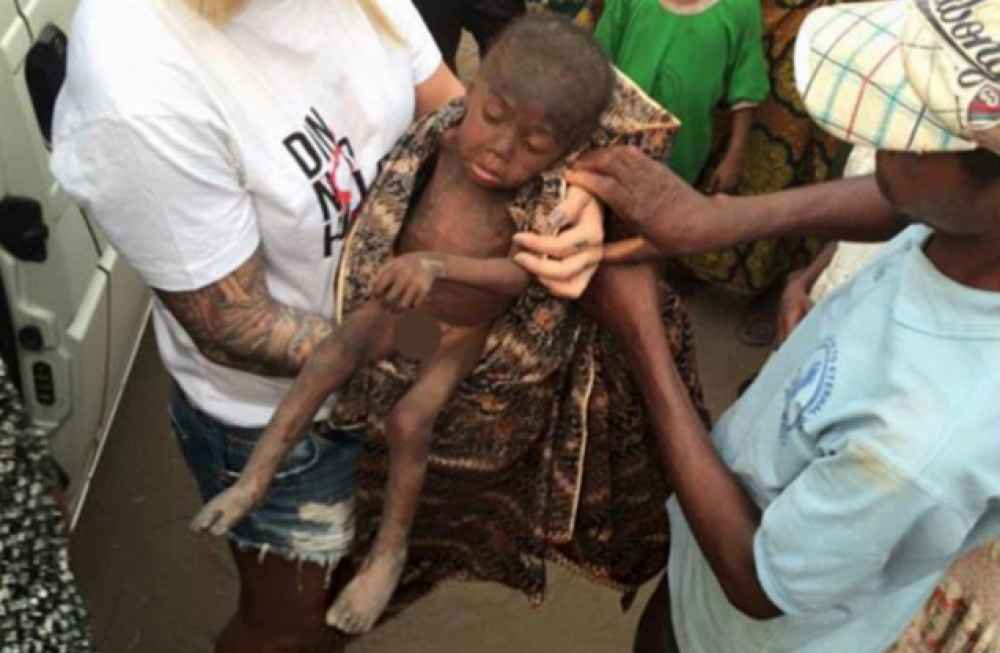 A fost salvat de o daneza, dupa ce fusese alungat de acasa si lasat sa moara de foame. Cum arata acum copilul din Nigeria - Imaginea 1