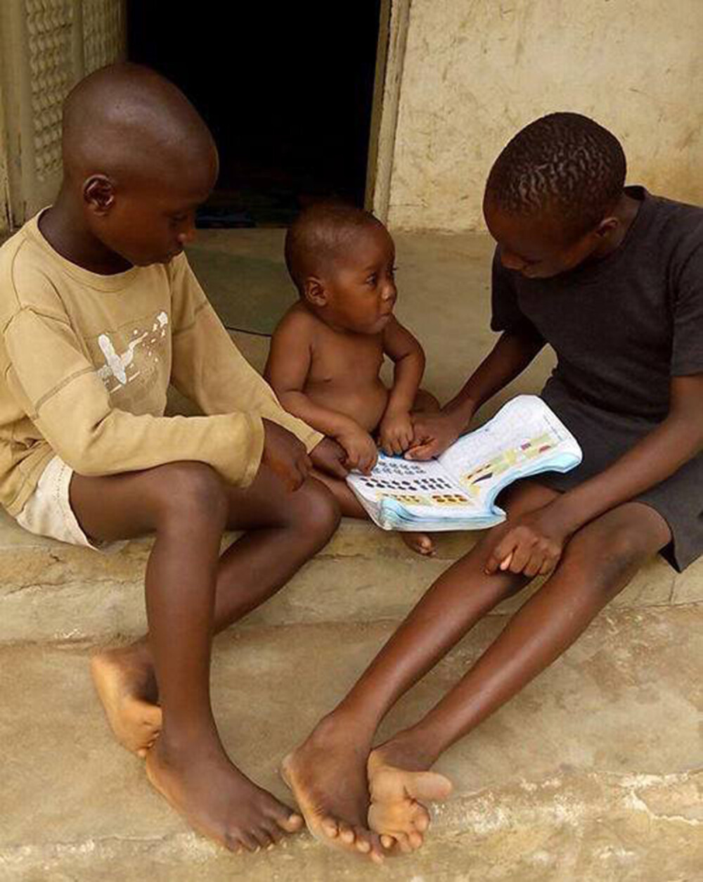 A fost salvat de o daneza, dupa ce fusese alungat de acasa si lasat sa moara de foame. Cum arata acum copilul din Nigeria - Imaginea 2