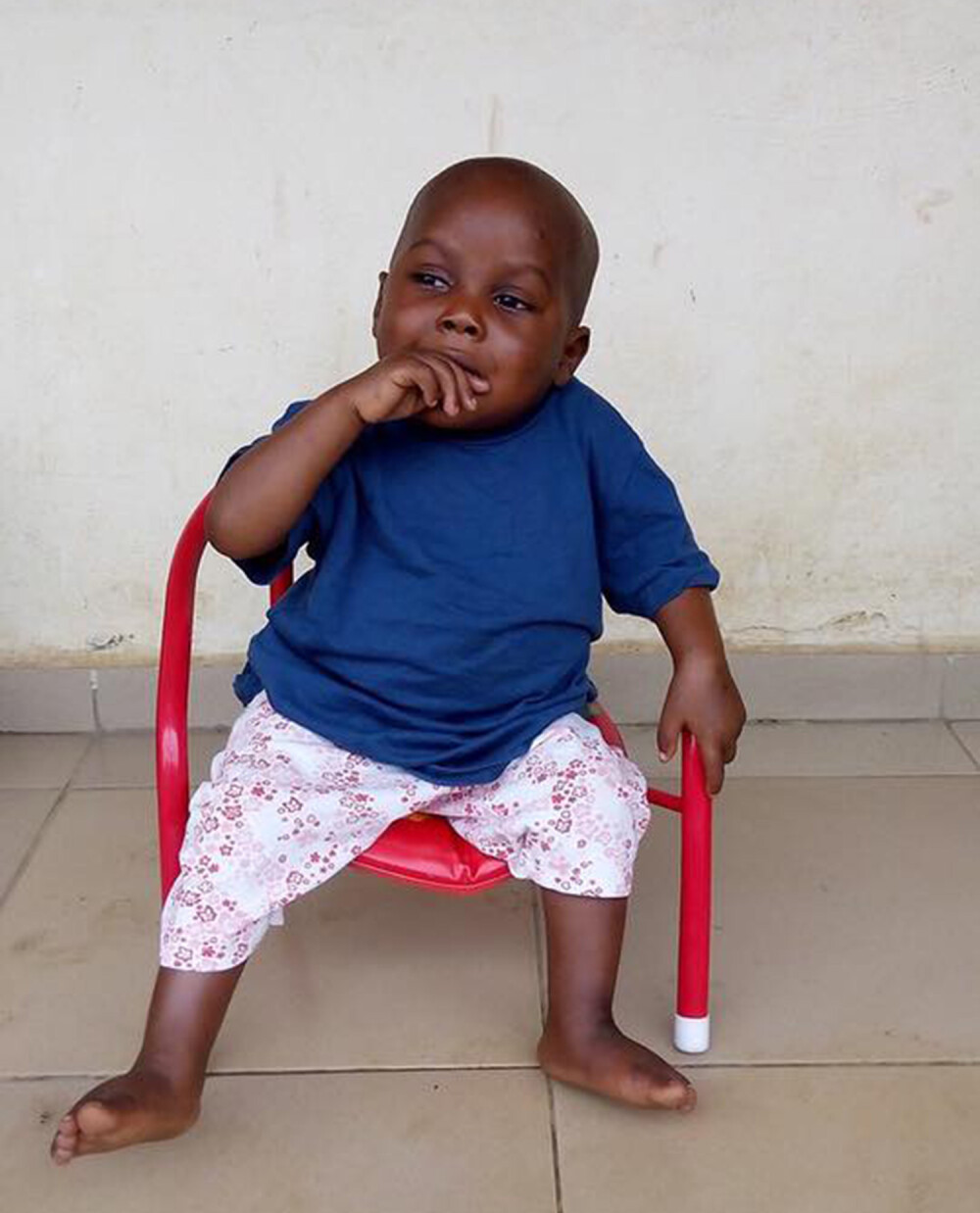 A fost salvat de o daneza, dupa ce fusese alungat de acasa si lasat sa moara de foame. Cum arata acum copilul din Nigeria - Imaginea 3