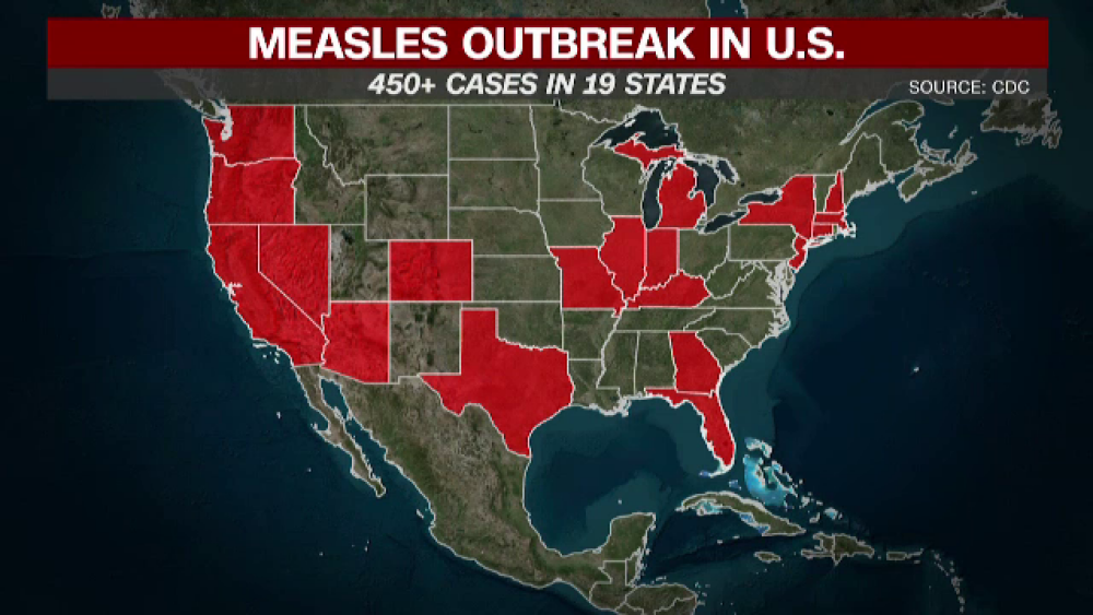 Stare de urgență în SUA din cauza pojarului. Ce amenzi riscă cei care nu se vaccinează - Imaginea 2