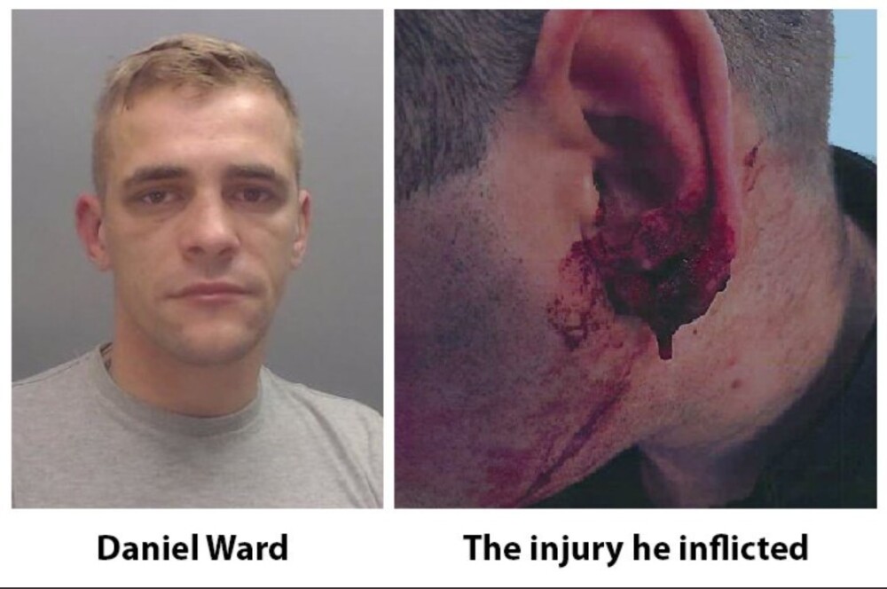 Cum arată un polițist, după ce a fost mușcat de ureche de un hoț. Ce a pățit agresorul - Imaginea 1
