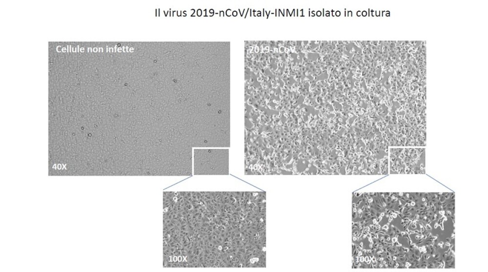 Cum arată coronavirusul care produce COVID-19. Imagini în premieră, de la cercetători - Imaginea 1
