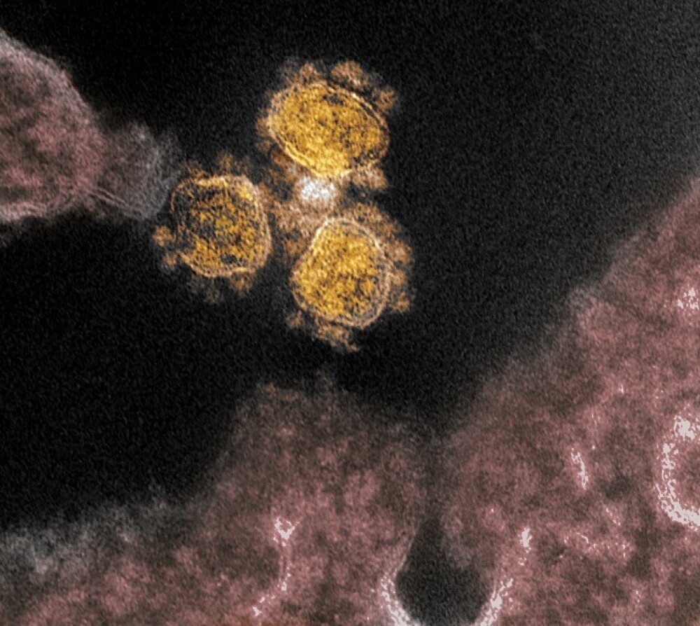 Cum arată coronavirusul care produce COVID-19. Imagini în premieră, de la cercetători - Imaginea 3