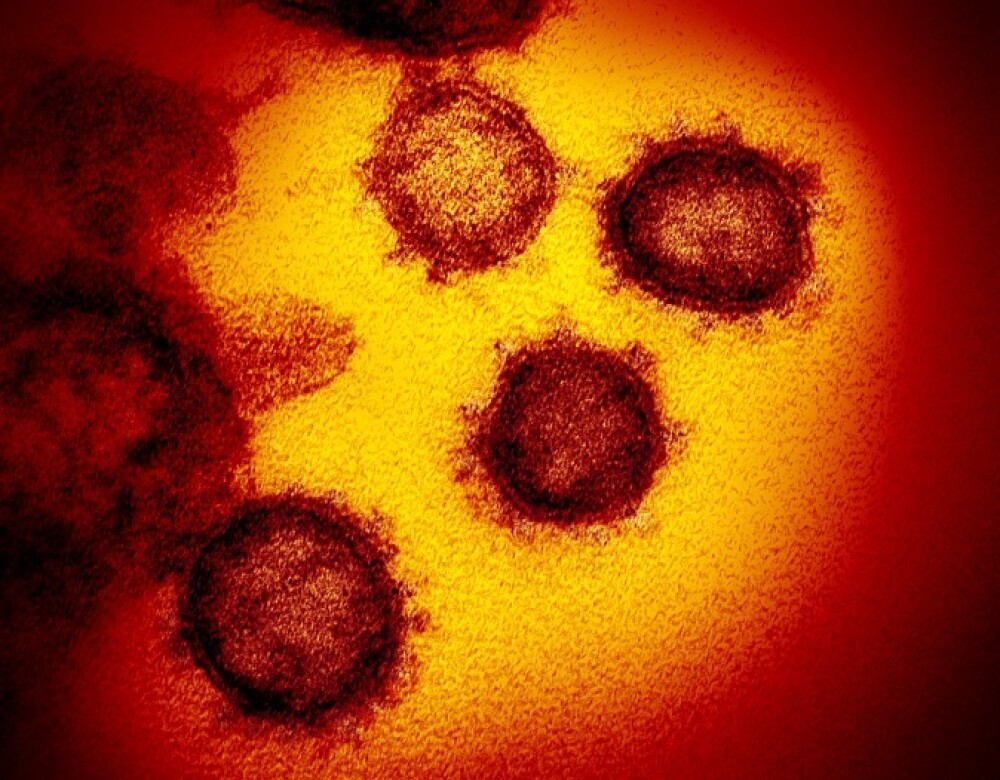 Cum arată coronavirusul care produce COVID-19. Imagini în premieră, de la cercetători - Imaginea 11