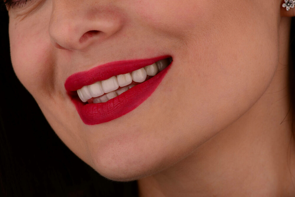 (P) Tu știi ce mai face dintele tău? Sfaturile specialiștilor pentru a te bucura timp îndelungat de o dantură sănătoasă - Imaginea 3