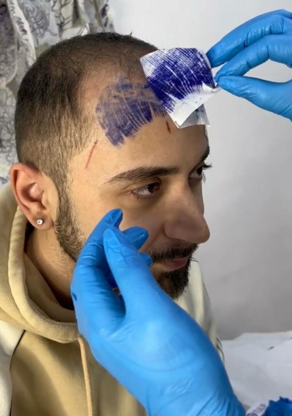 Cum arată un bărbat după ce și-a tatuat un breton pe frunte pentru că avea început de chelie. Care a fost reacția lui | FOTO - Imaginea 5