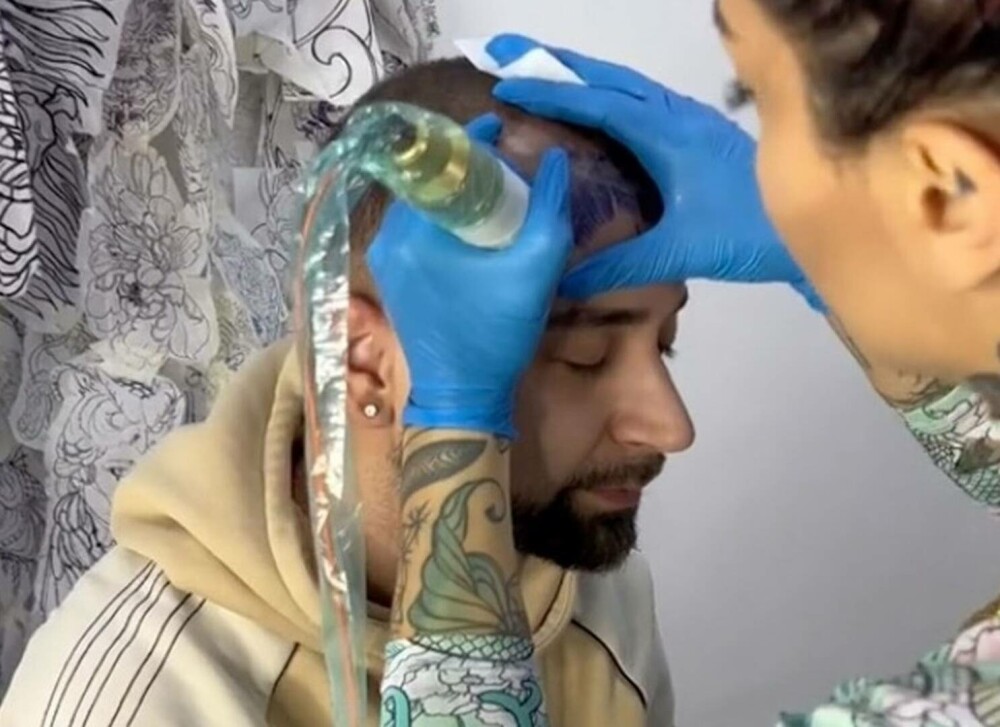 Cum arată un bărbat după ce și-a tatuat un breton pe frunte pentru că avea început de chelie. Care a fost reacția lui | FOTO - Imaginea 12
