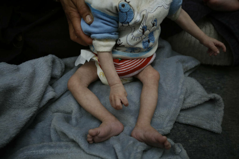 Imaginile foametei din Gaza. Raport: Jumătate din populație va suferi de foamete în aproximativ trei luni | FOTO - Imaginea 27