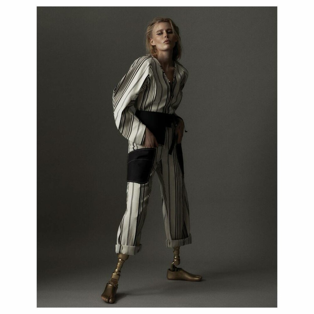 Cum arată modelul care și-a pierdut ambele picioare din cauza unui tampon. „Picioarele mele erau în flăcări” | GALERIE FOTO - Imaginea 16