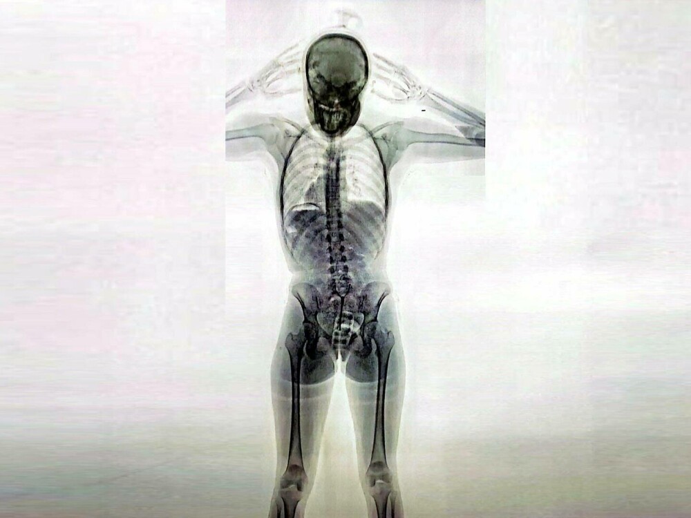 O femeie a fost reținută pe aeroport după ce corpul i-a fost scanat cu raze X. Incredibil ce au descoperit polițiștii | FOTO - Imaginea 5