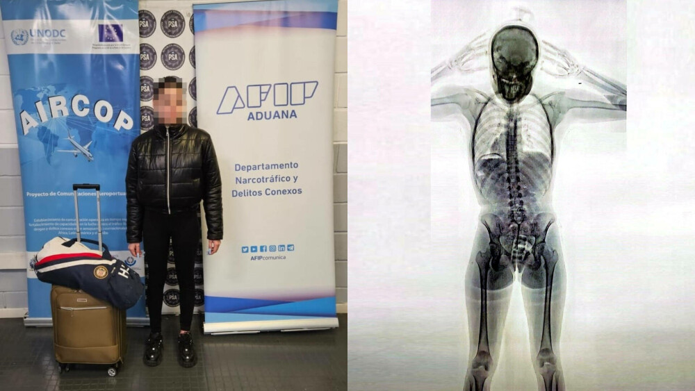 O femeie a fost reținută pe aeroport după ce corpul i-a fost scanat cu raze X. Incredibil ce au descoperit polițiștii | FOTO - Imaginea 6