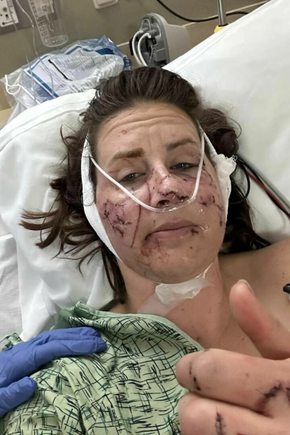 „Am crezut că mă va ucide”. O femeie a fost atacată brutal de un animal care la prima vedere pare inofensiv | IMAGINI ȘOCANTE - Imaginea 5