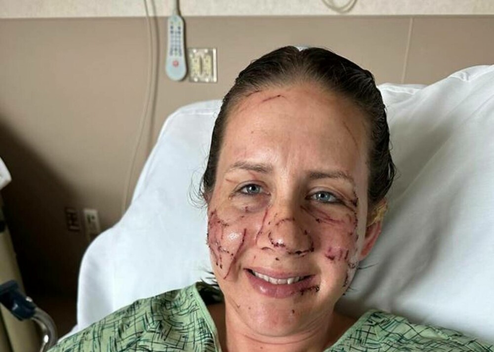 „Am crezut că mă va ucide”. O femeie a fost atacată brutal de un animal care la prima vedere pare inofensiv | IMAGINI ȘOCANTE - Imaginea 1
