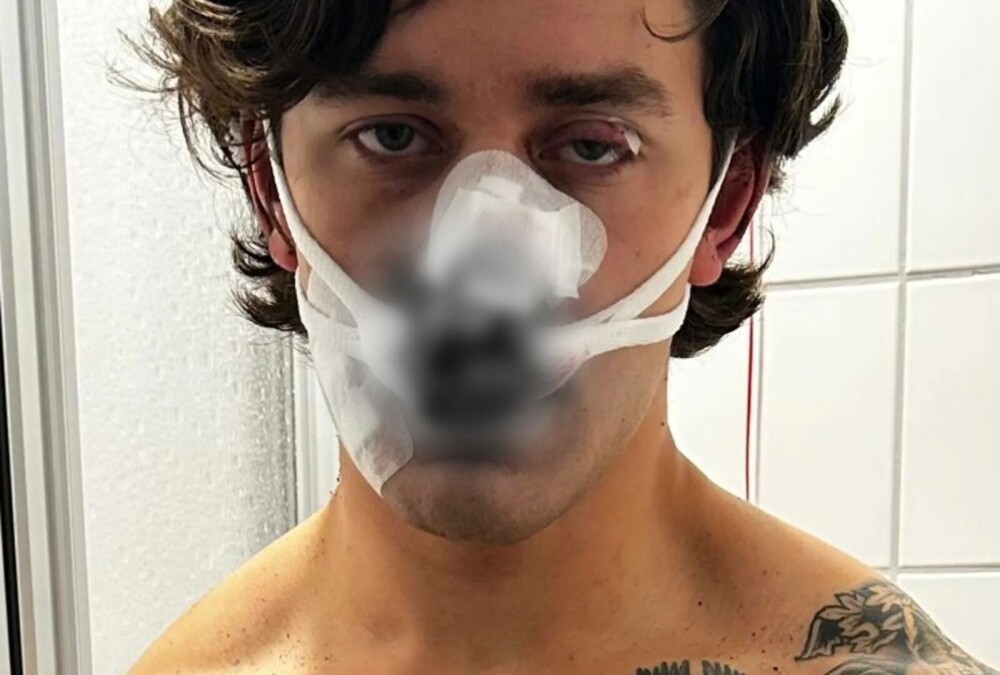 Un tânăr a fost înjunghiat în față după ce a încercat să apere două femei agresate de niște indivizi în Germania - Imaginea 2