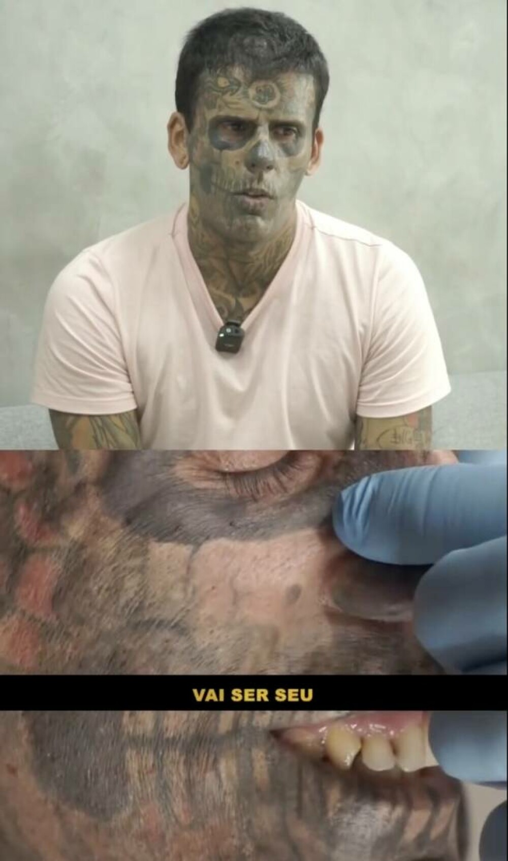 Un bărbat care și-a tatuat 95% din corp dezvăluie cum arată după cinci intervenții de îndepărtare a tatuajelor. FOTO - Imaginea 6