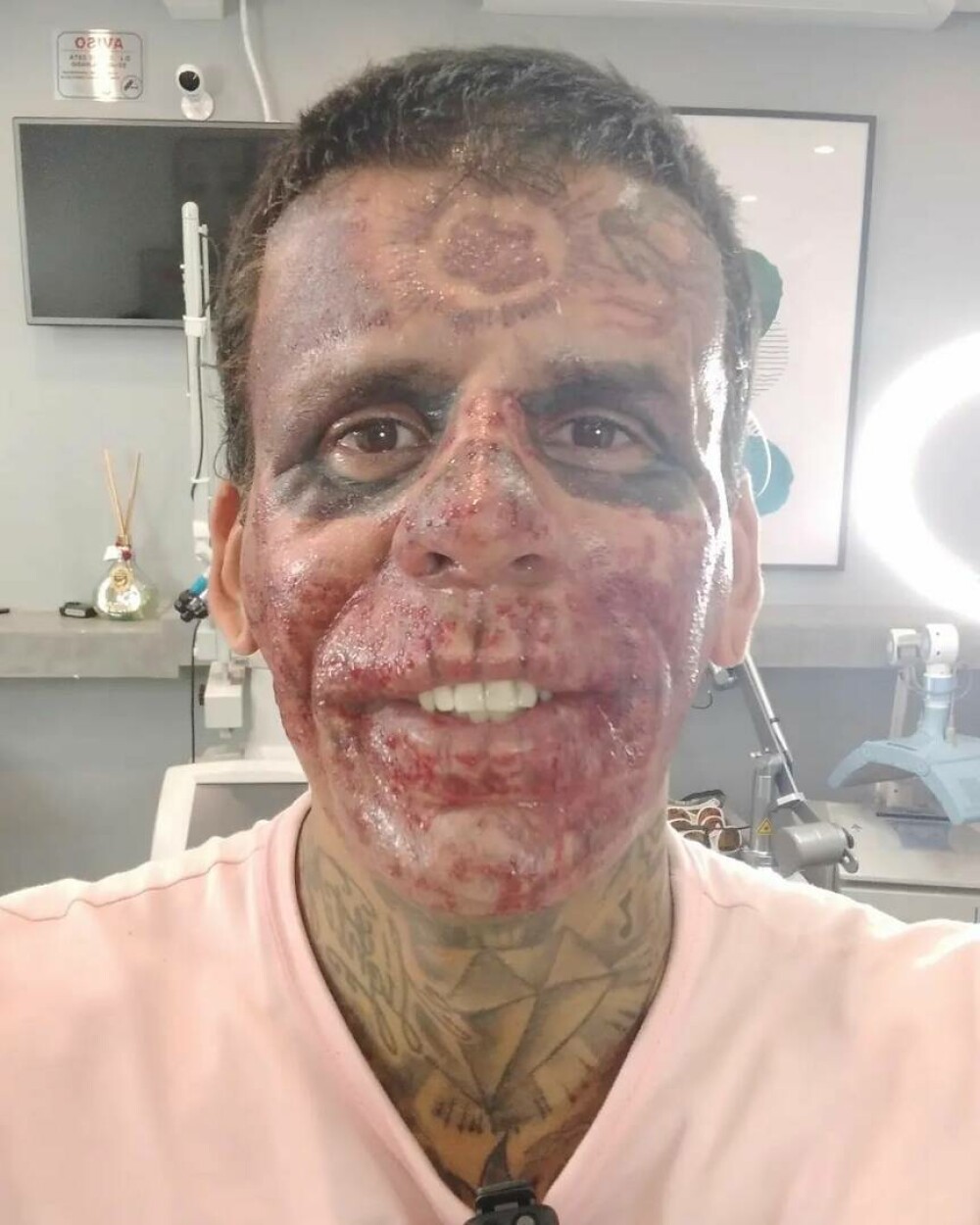 Un bărbat care și-a tatuat 95% din corp dezvăluie cum arată după cinci intervenții de îndepărtare a tatuajelor. FOTO - Imaginea 3