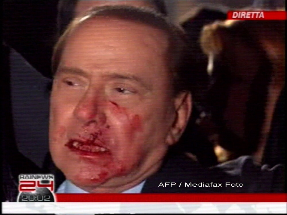 Silvio Berlusconi, plin de sange! Are nasul spart si doi dinti rupti! - Imaginea 1
