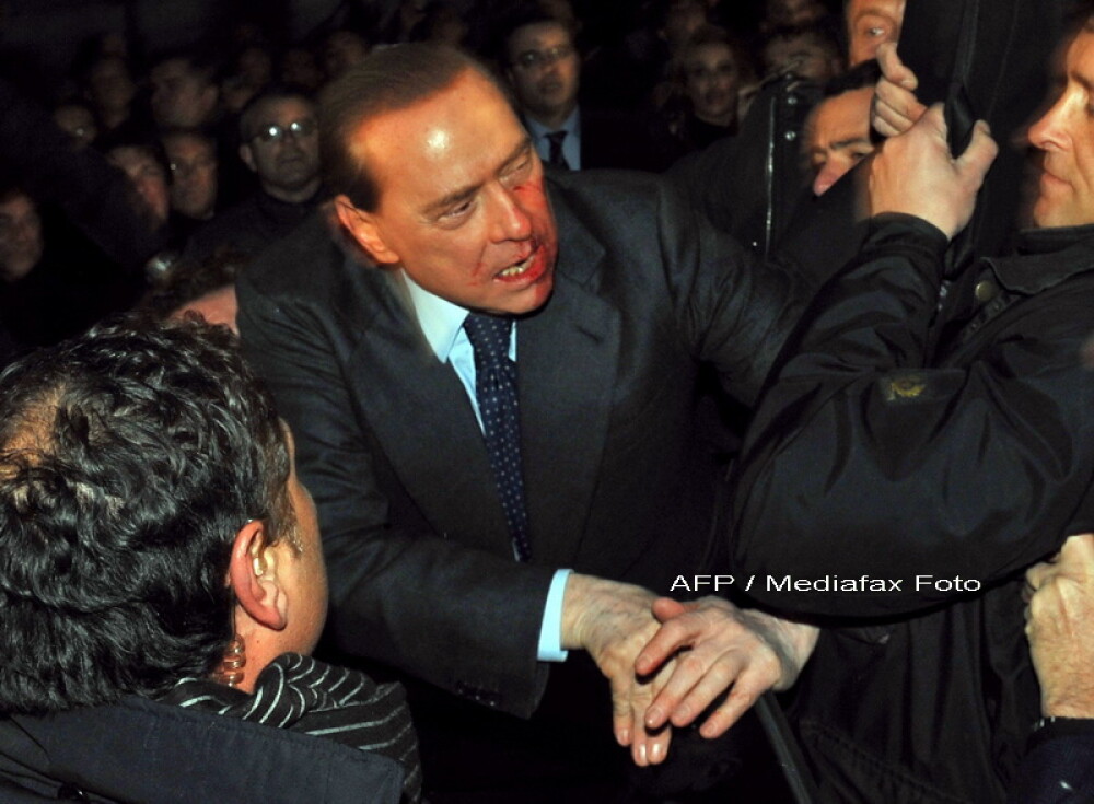 Silvio Berlusconi, plin de sange! Are nasul spart si doi dinti rupti! - Imaginea 3