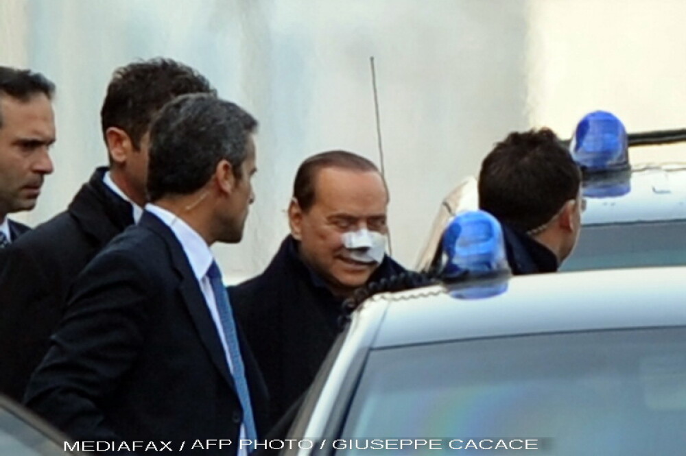 Silvio Berlusconi a fost externat din spital. E plin de bandaje - Imaginea 2