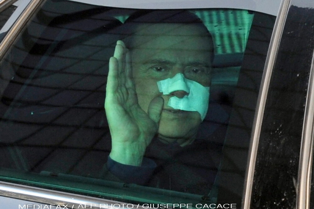 Silvio Berlusconi a fost externat din spital. E plin de bandaje - Imaginea 3