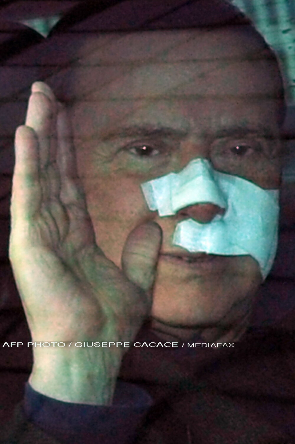 Silvio Berlusconi a fost externat din spital. E plin de bandaje - Imaginea 5