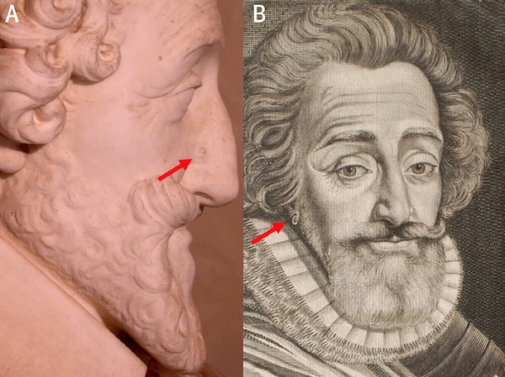 Craniul regelui francez Henric IV, gasit in casa unui pensionar! - Imaginea 2