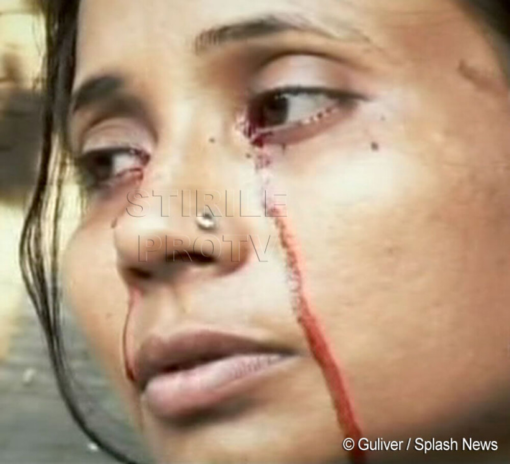 O femeie din India plange cu lacrimi de sange! FOTO - Imaginea 1