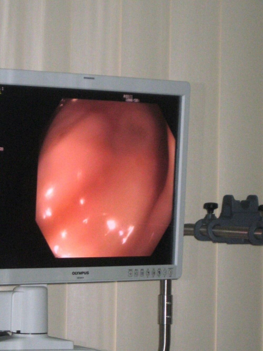 Un endoscop de mare precizie, util in prevenirea cancerului, a fost pus in functiune la Arad - Imaginea 2