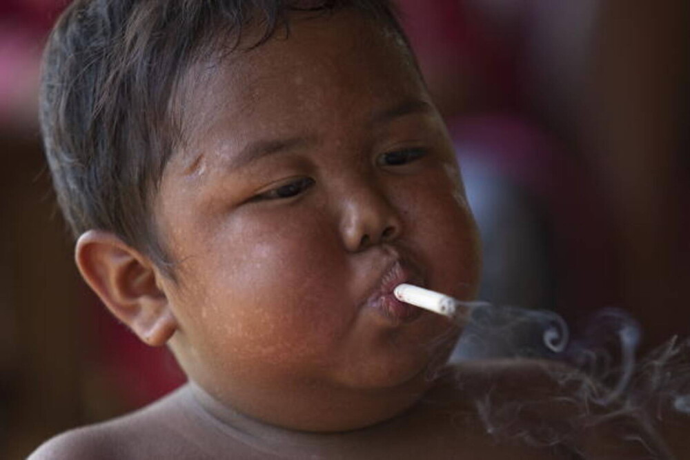 Copilul care fuma 40 de țigări pe zi la doar doi ani s-a lăsat de fumat. Cum arată | FOTO - Imaginea 8