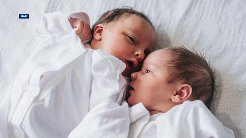 O femeie a născut două fetițe gemene din două utere diferite, una pe cale naturală și una prin cezariană - Imaginea 2