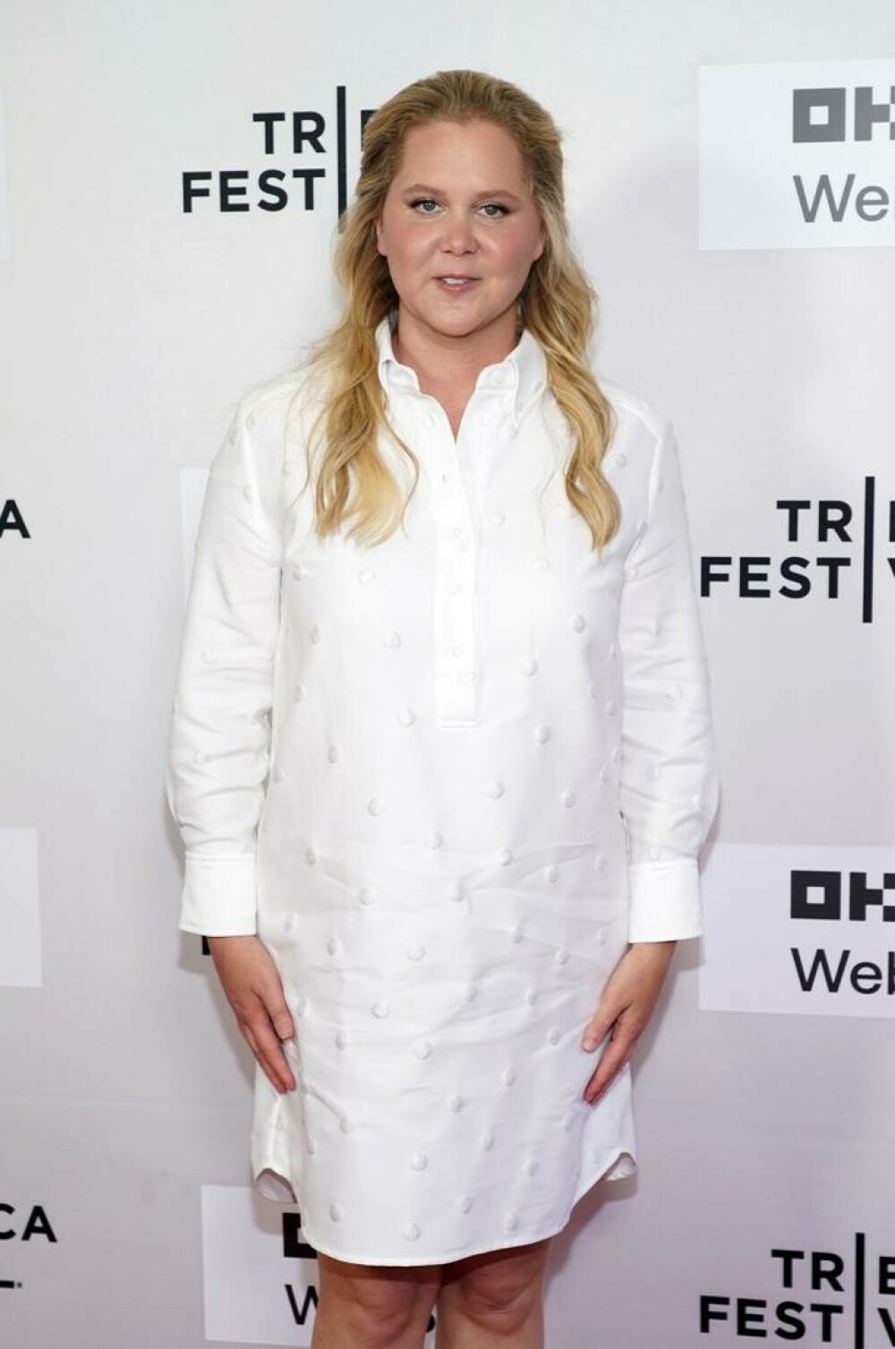 Amy Schumer, despre boala care i-a provocat scăderea dramatică în greutate: „Am slăbit ca să supraviețuiesc” - Imaginea 2
