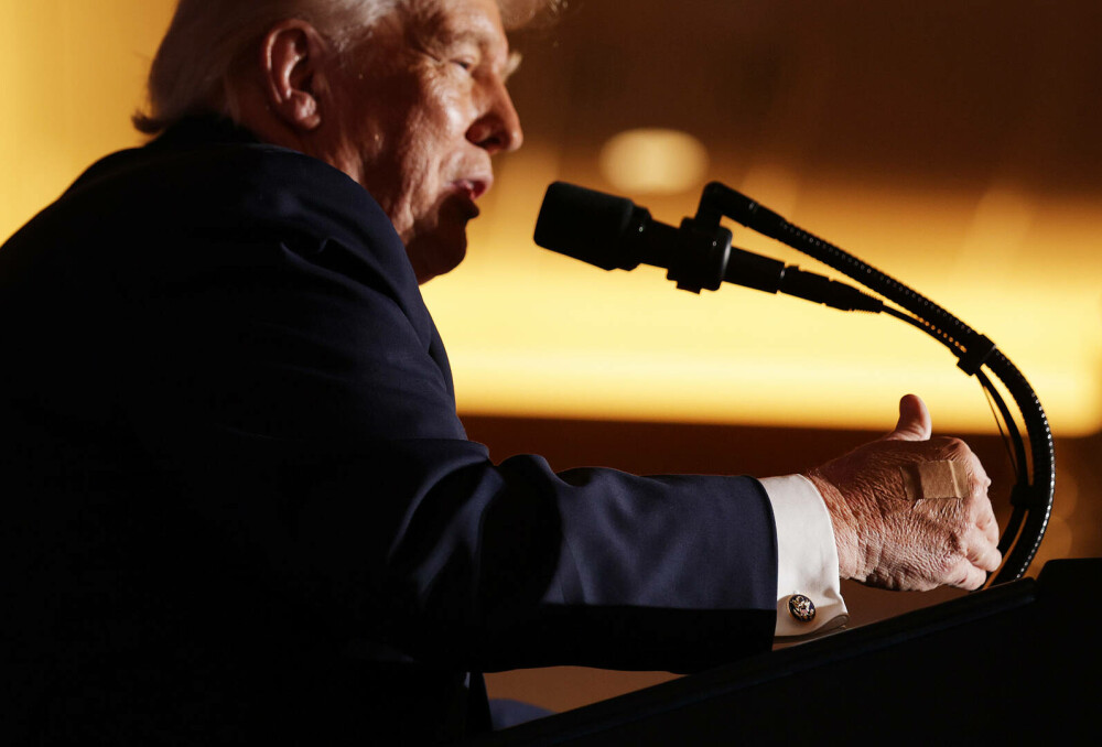 Donald Trump poartă un pansament, iar Casa Albă invocă strângerile de mână. FOTO - Imaginea 2