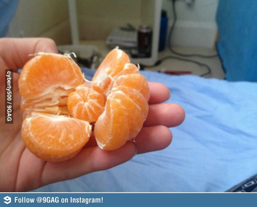 Ce a descoperit un barbat intr-o portocala. Poza care a devenit virala pe internet. FOTO - Imaginea 1