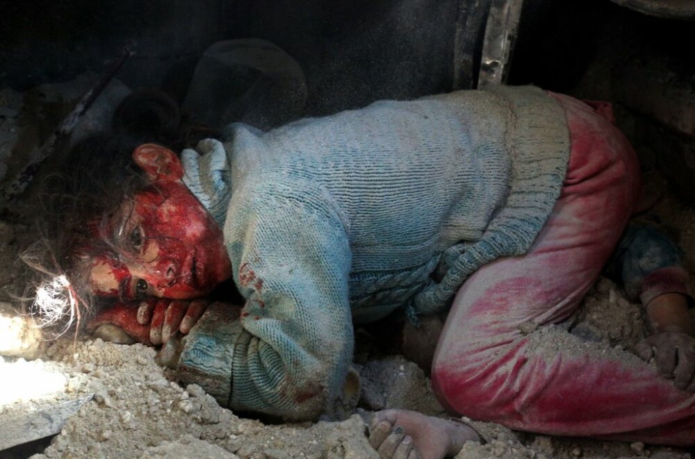 Imaginile dezastrului în Siria. Povestea fetiței care zace lângă sora sa decedată - Imaginea 3
