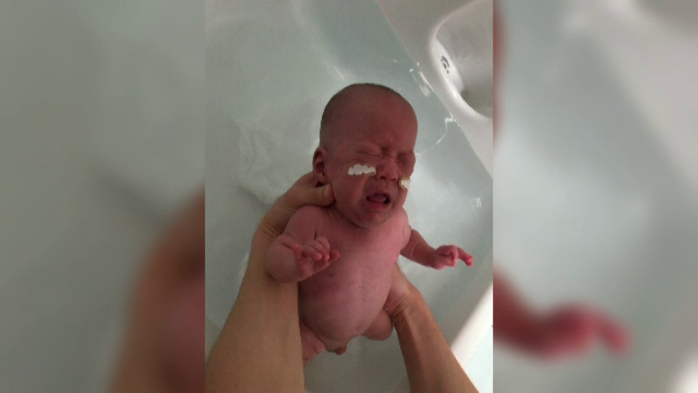 Bebelușul care cântărea 268 de grame la naștere a fost externat. Ce spun părinții - Imaginea 3