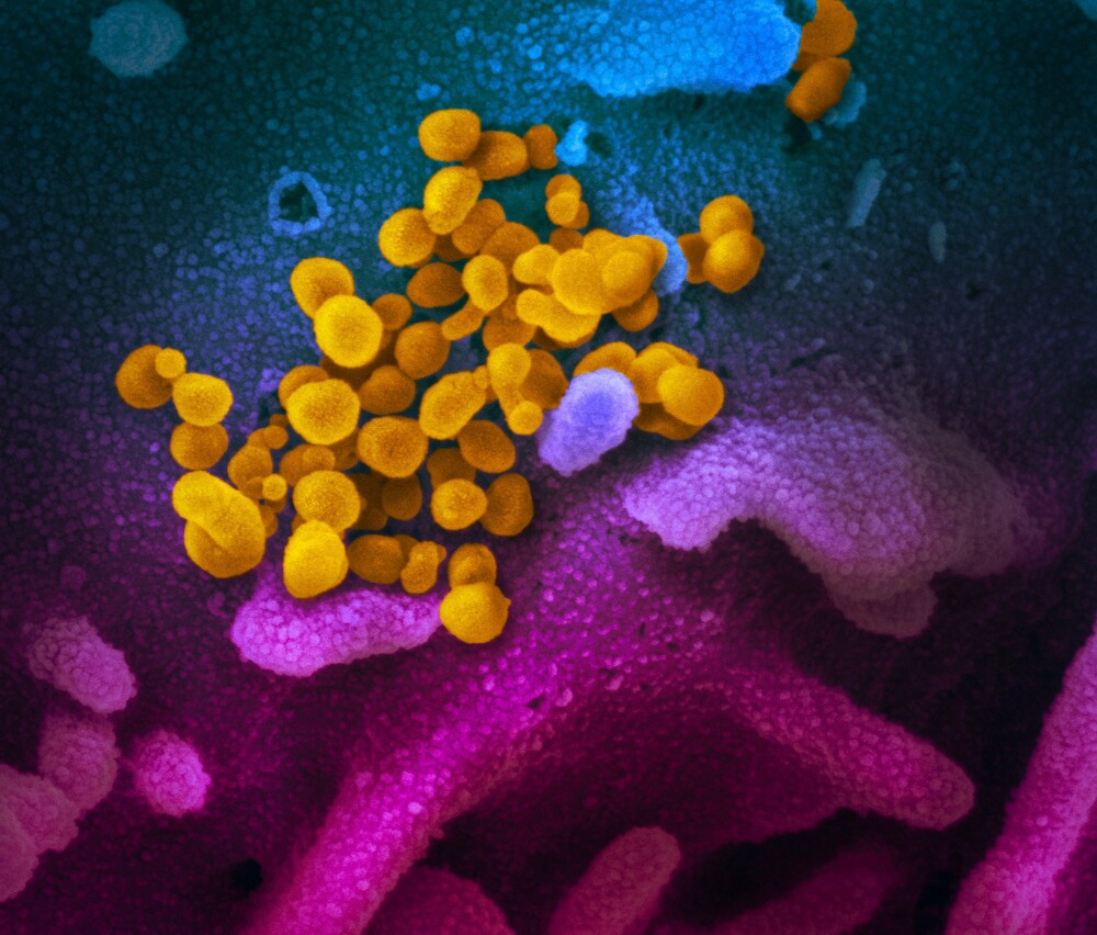 FOTO. Cum arată coronavirusul văzut la microscop. Imaginile publicate de cercetători - Imaginea 2