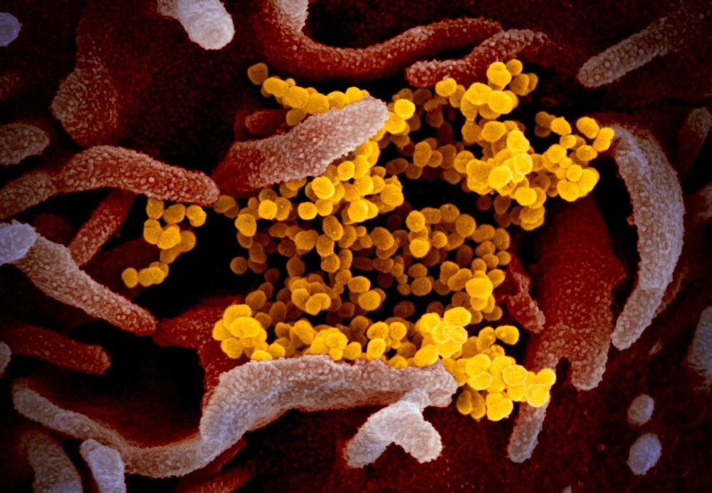 FOTO. Cum arată coronavirusul văzut la microscop. Imaginile publicate de cercetători - Imaginea 3