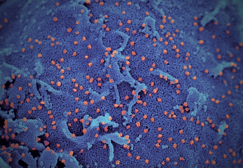 FOTO. Cum arată coronavirusul văzut la microscop. Imaginile publicate de cercetători - Imaginea 5