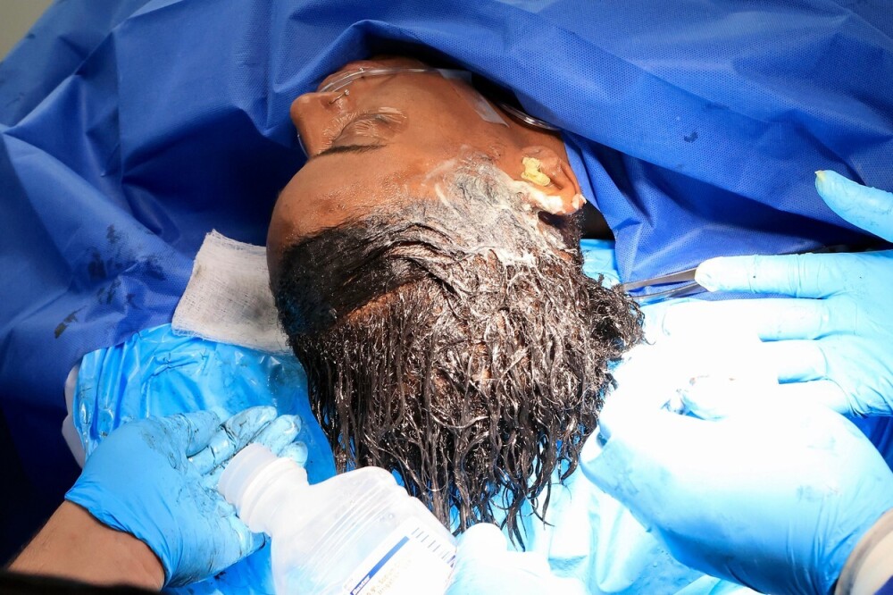 Decizia luată de femeia care și-a dat intenționat cu lipici în cap, după ce un medic a tratat-o gratuit - Imaginea 7