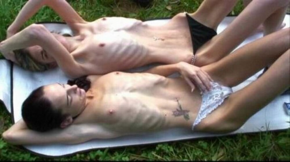 IMAGINI SOCANTE! Mumii ambulante: femei macinate de anorexie! - Imaginea 8
