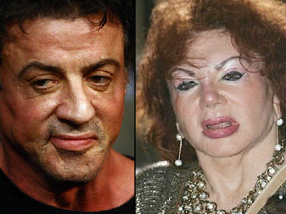 Asa mama, asa fiu!Jackie si Sylvester Stallone, fideli operatiilor estetice - Imaginea 1