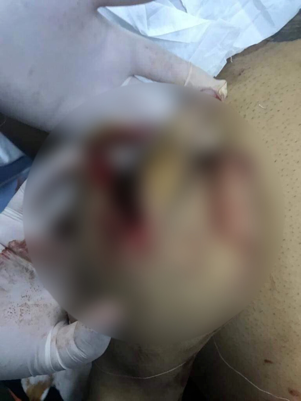 Imagini șocante cu interlopul Bebino, internat în spital după ce fost mutilat de un rival - Imaginea 1