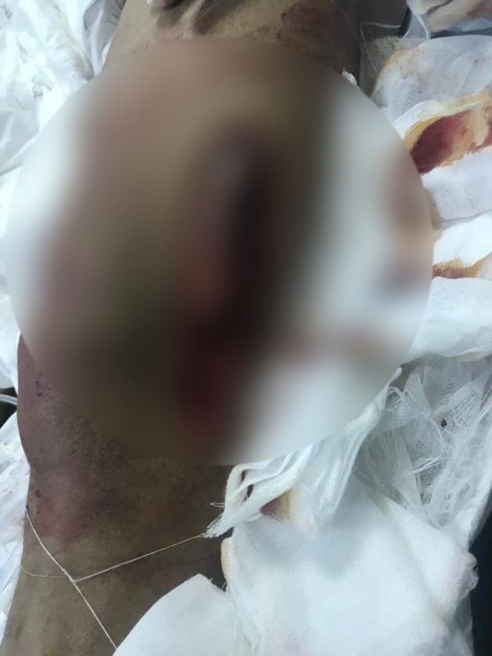 Imagini șocante cu interlopul Bebino, internat în spital după ce fost mutilat de un rival - Imaginea 2
